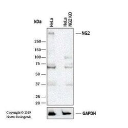 NG2/MCSP Antibody (LHM 2) - Azide and BSA Free, Novus Biologicals 0.1 mL;